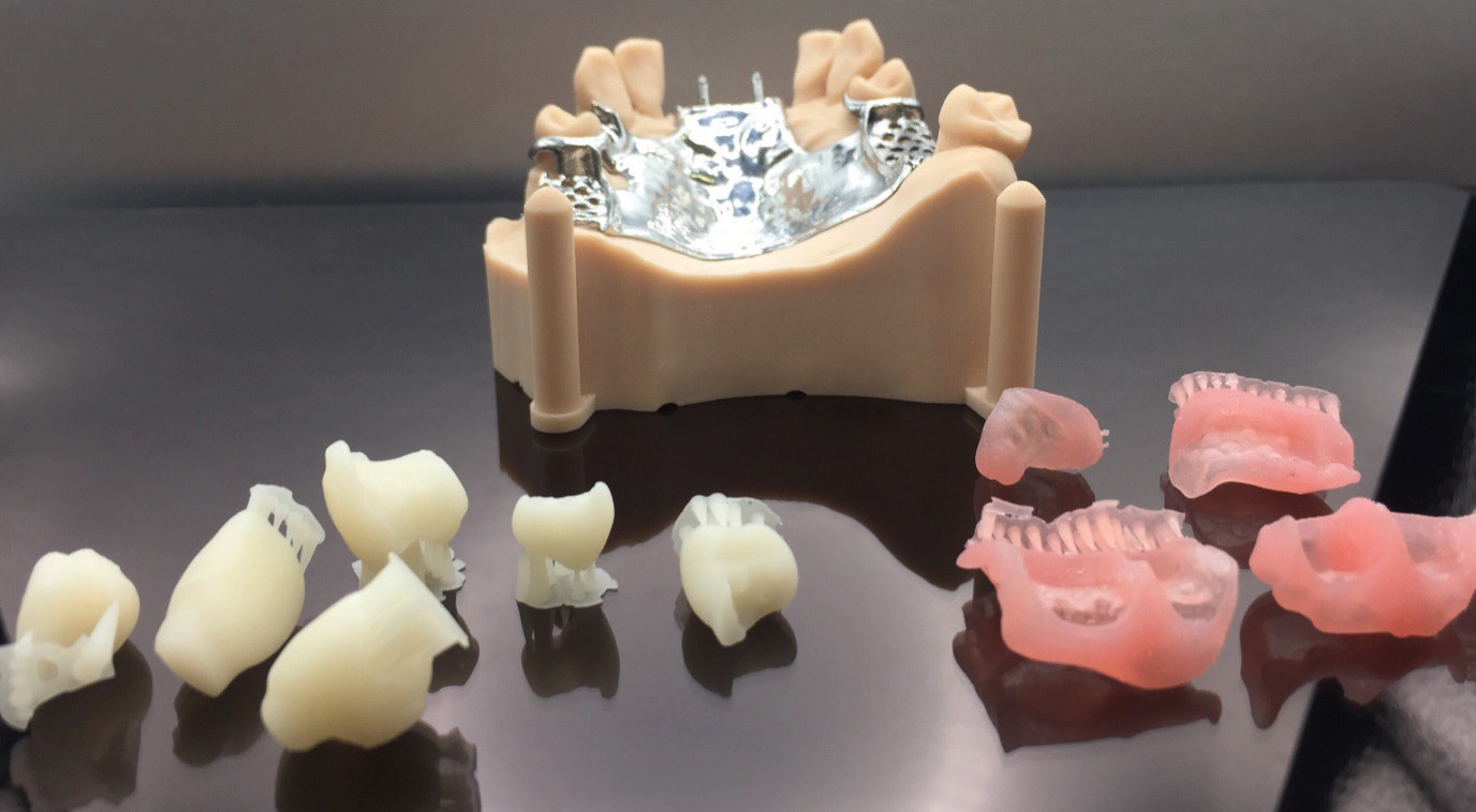 Digital Dentures Transition of the workflow GoDigital Dental