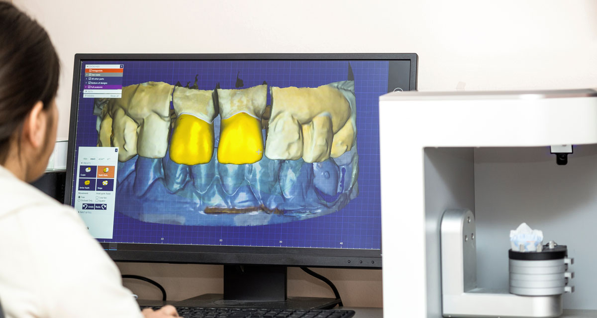 Behind the scenes what happens inside a modern dental lab
