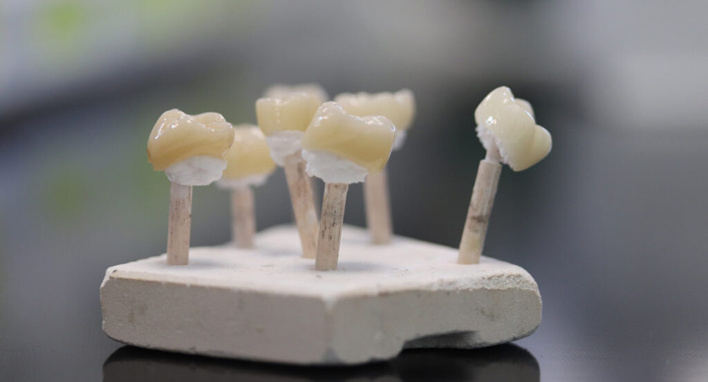 Collaboration and communication between labs and dentists