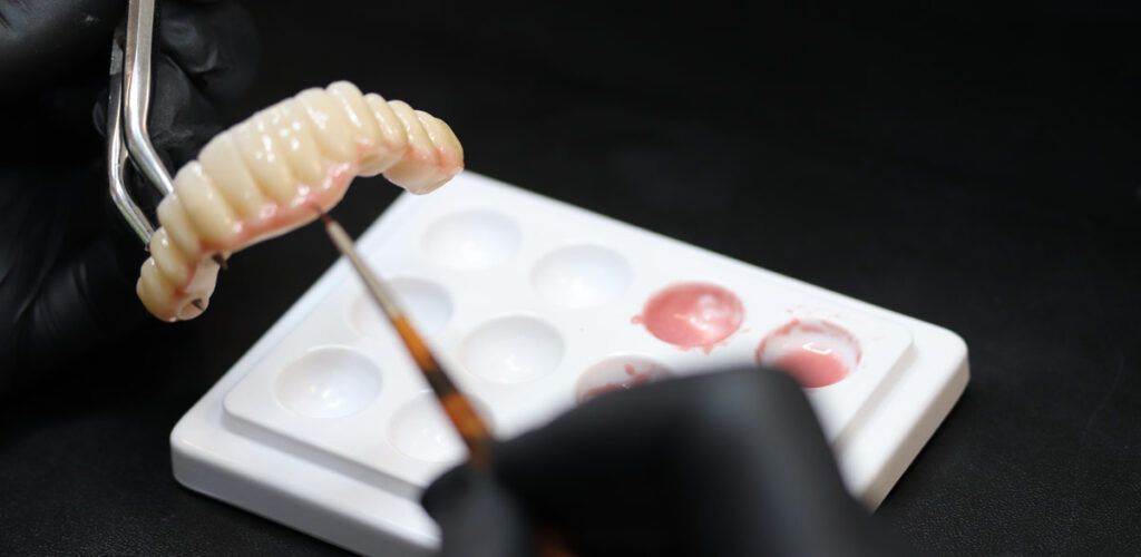 Customisation and precision in smile design