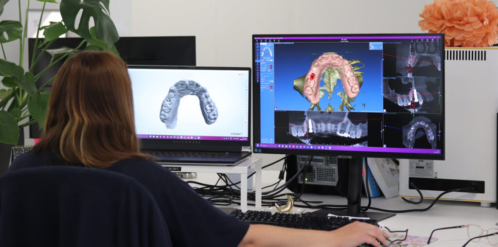 Cutting edge technology in dental laboratories