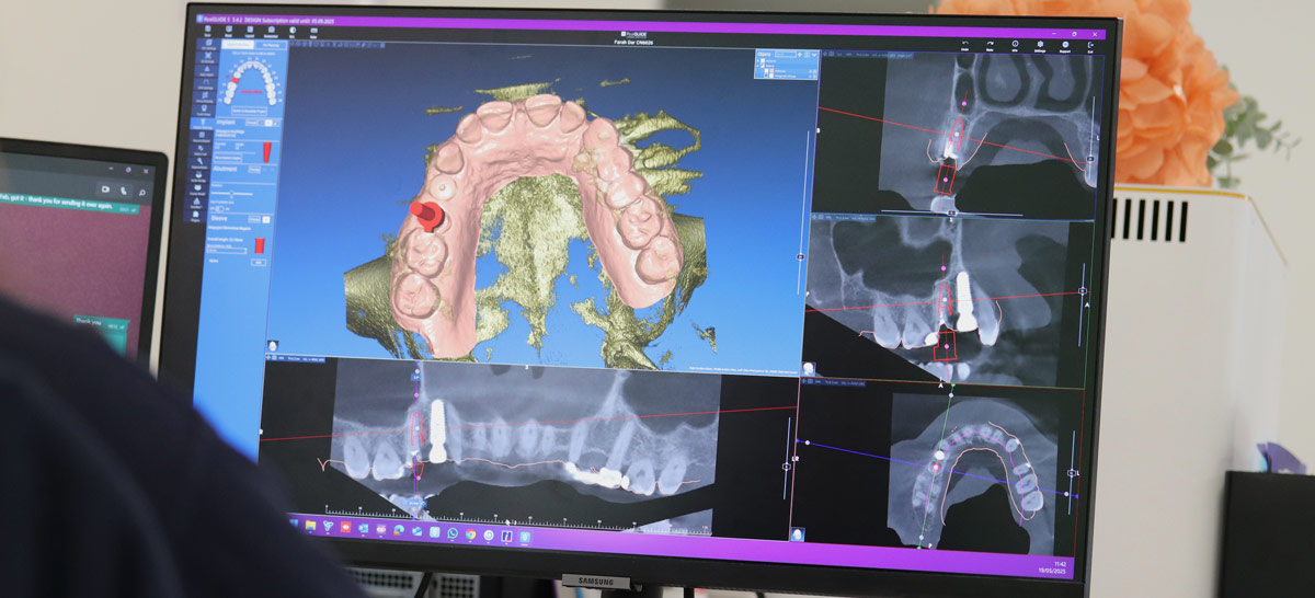 Dental laboratory innovations