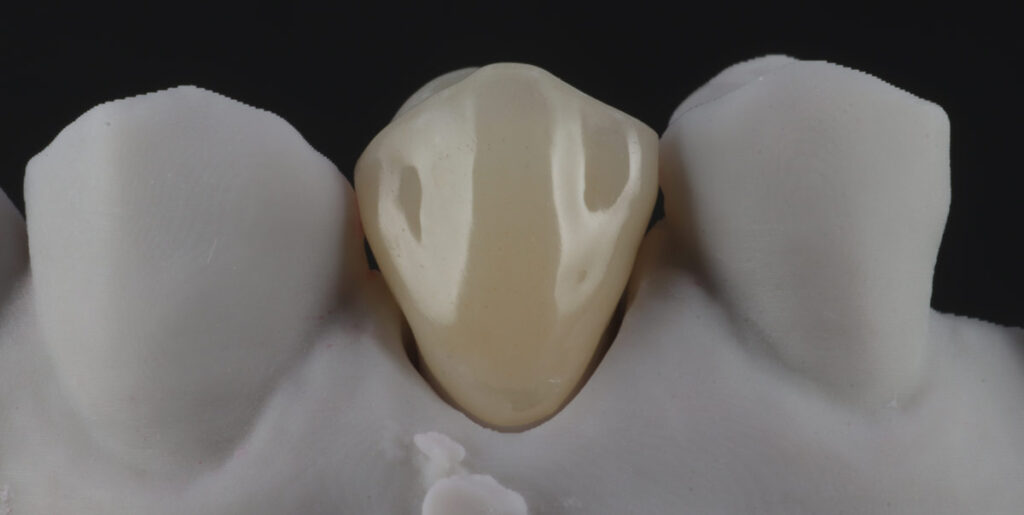 Designing the crown using technology