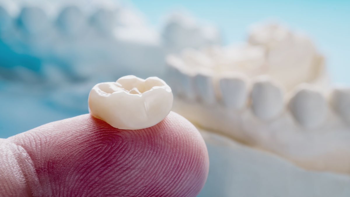 choosing a dental lab UK that matches your tech