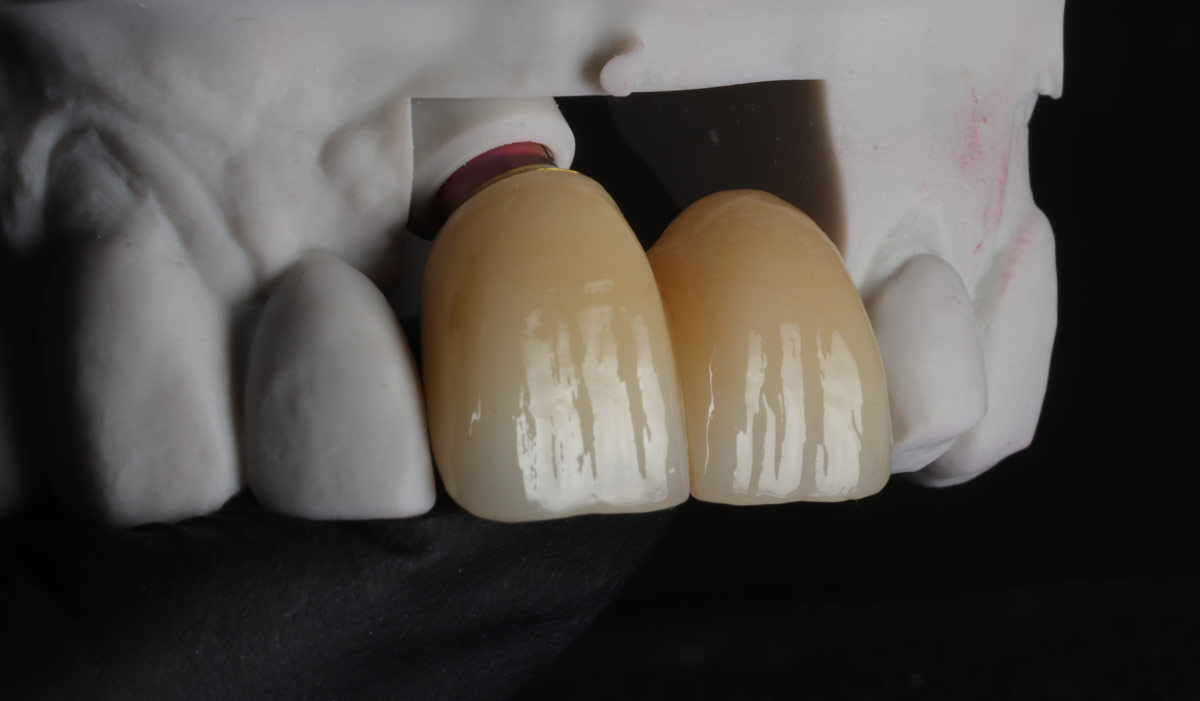 importance of professional dental lab services