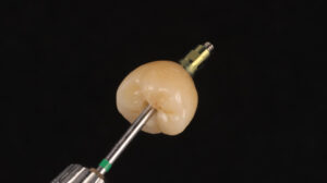 Implant on driver