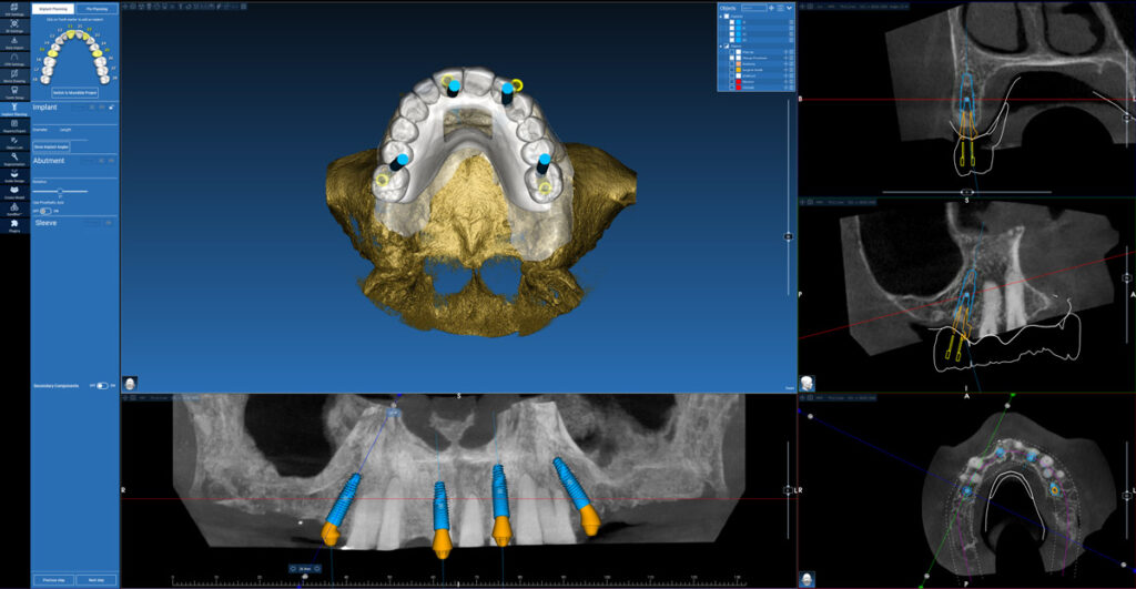 Technology and innovation in dental labs