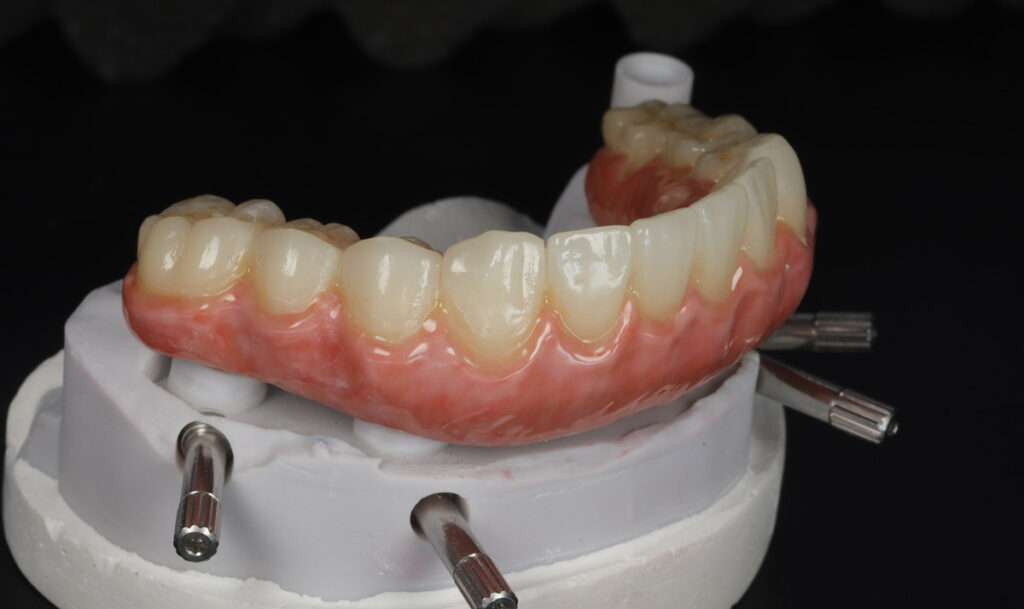 dental lab full teeth model