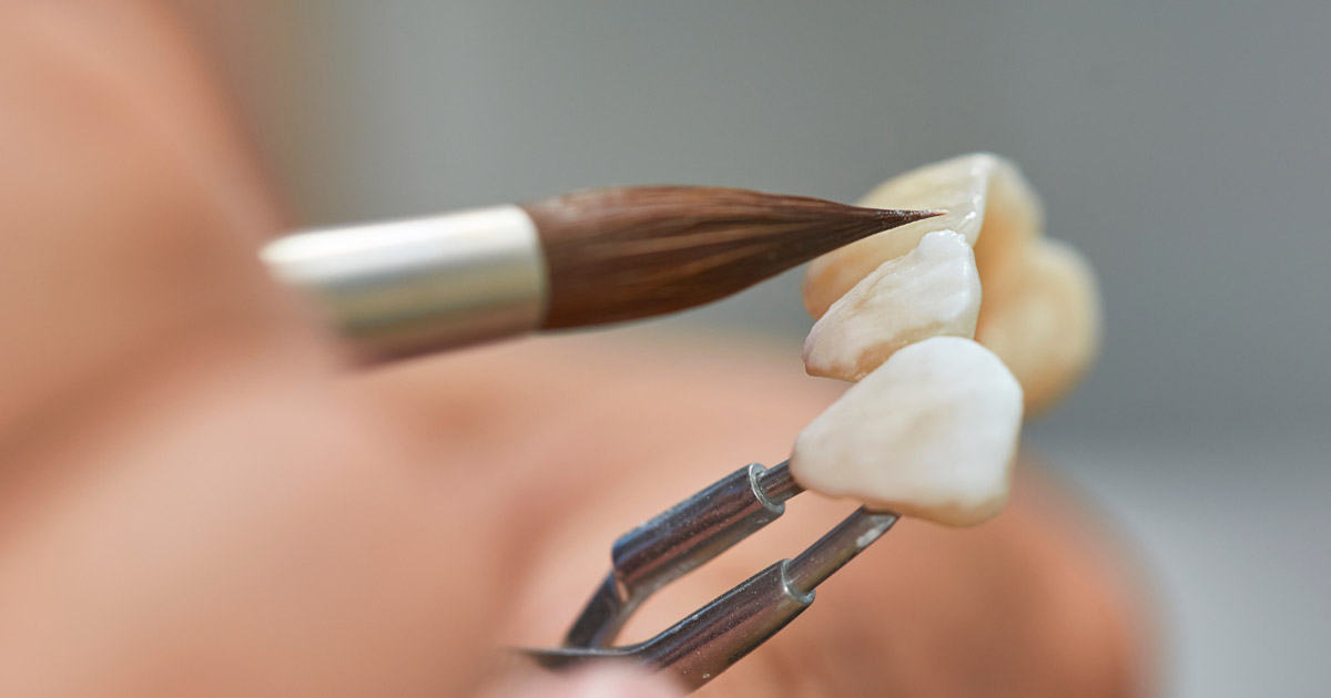oral ceramics lab