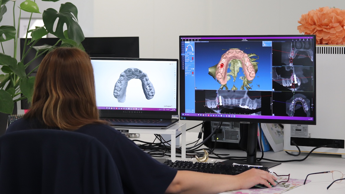 dental implant planning