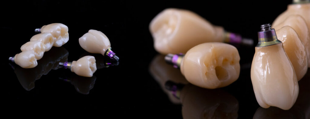 dental implants materials used showcase