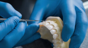 dental lab technician in creating beautiful restorations
