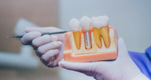dentist showing dental implant model