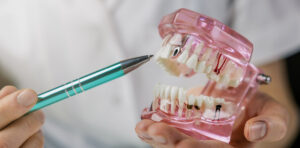 dentist showing patient implant treatment