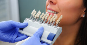 great dental lab near me dentist veneers