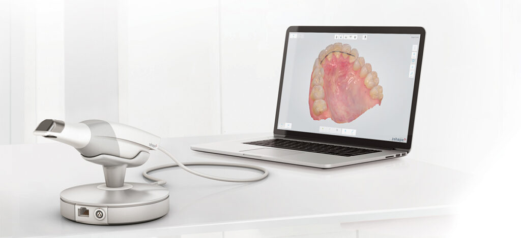 low cost dental implants uk digital workflow