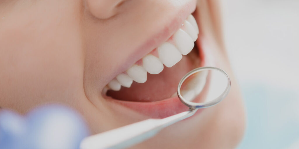 Why dental implants are a popular choice