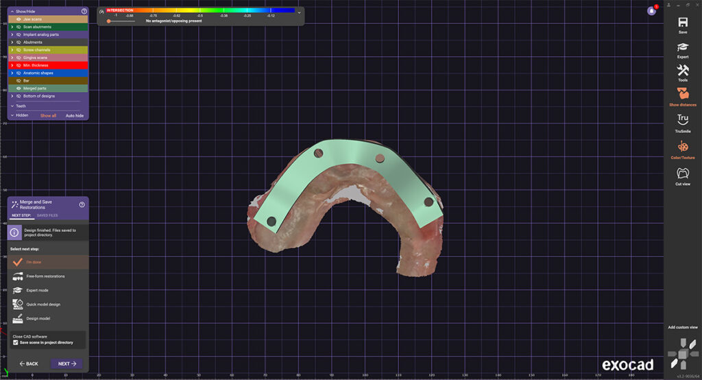 cheapest all on 4 implants digital lab