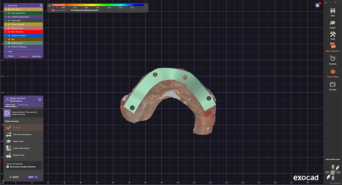 cheapest all on 4 implants digital lab
