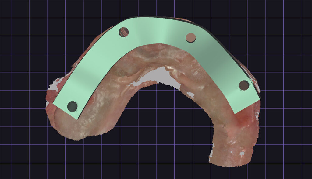 cheapest all on 4 implants verification jig