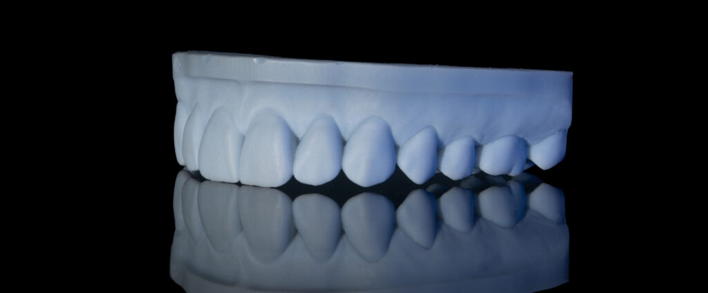 dental laboratory near me 3d print