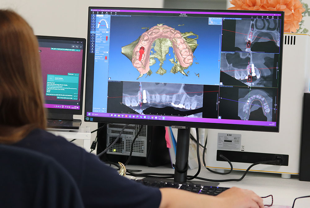 cad team dental laboratory