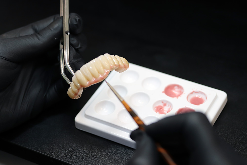 ceramic dental laboratory work