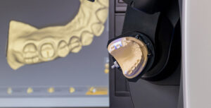 dental case acceptance tools scanner machine