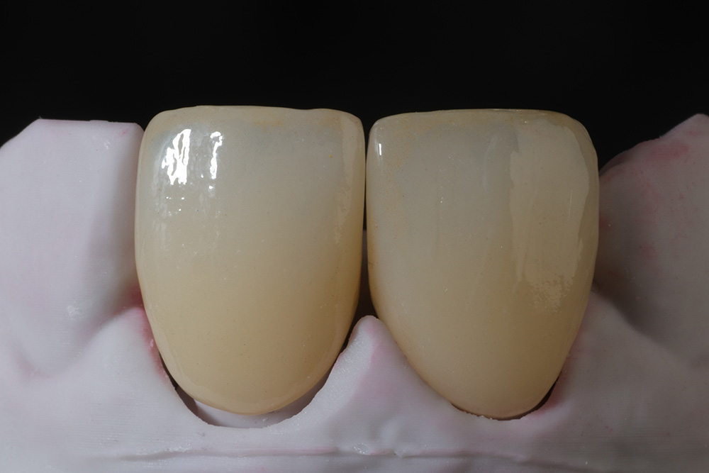 dental crown lab