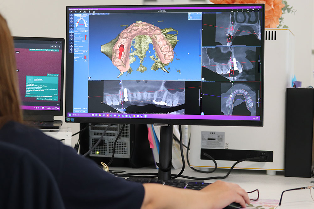 dental laboratory CAD CAM