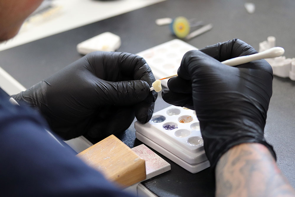 dental laboratory ceramics