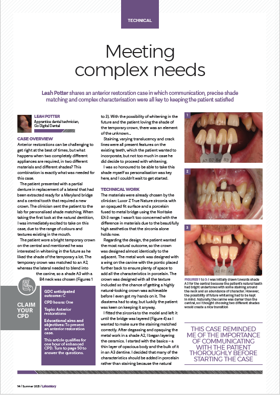 Leah article dental laboratory summer 2025