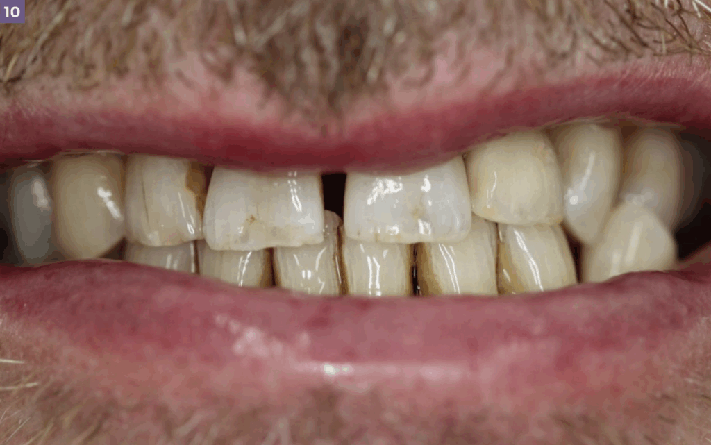 leah potter case overview final results 3