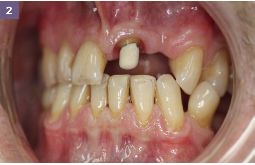 leah potter case overview shade matching 2