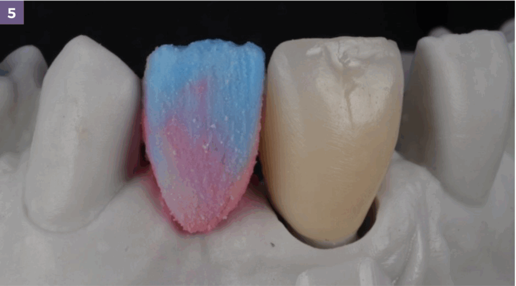 leah potter case overview zirconia process 2