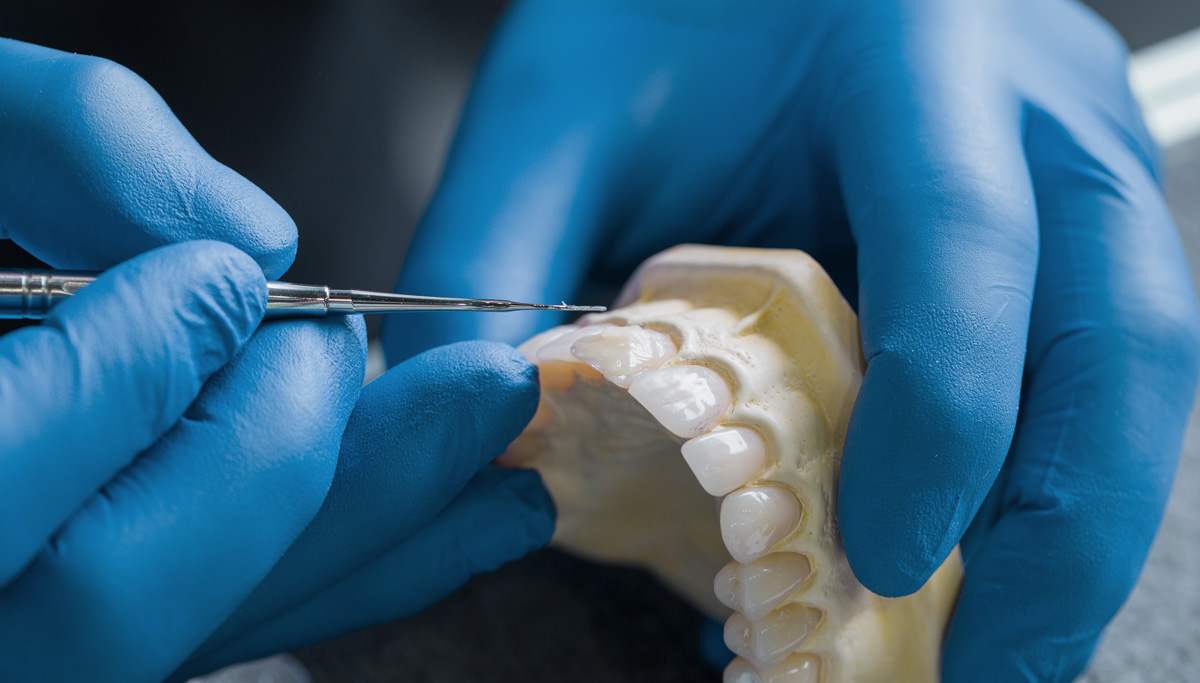 choosing digital dental lab