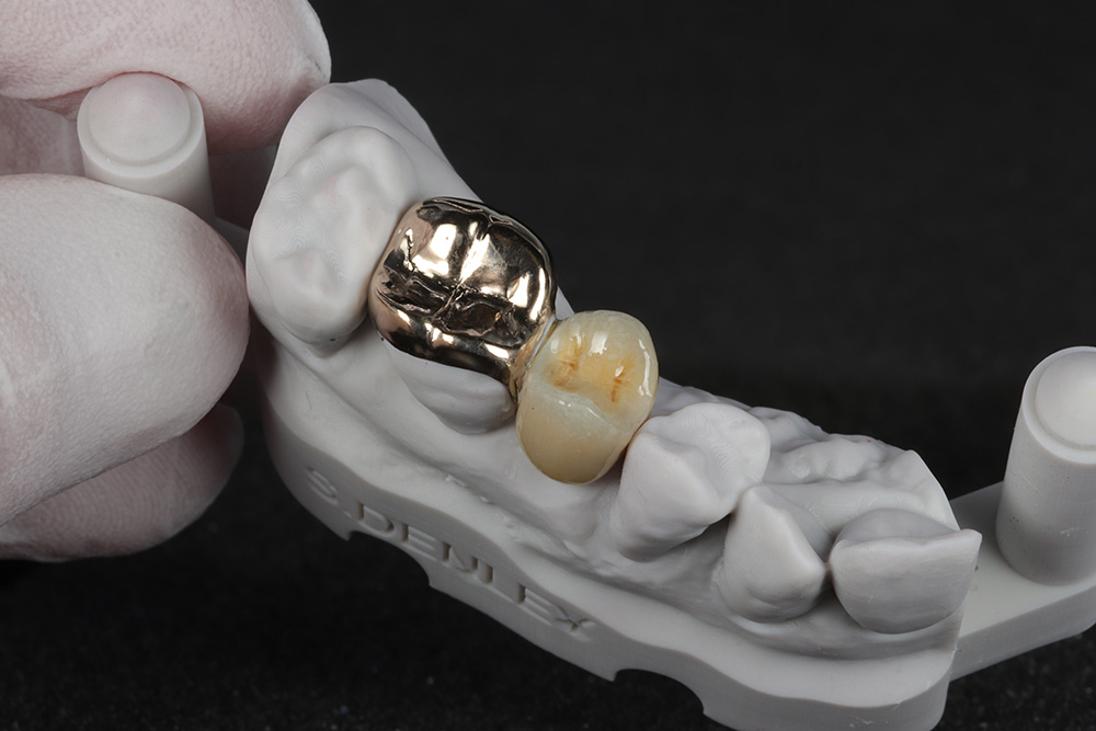 modern dental lab materials