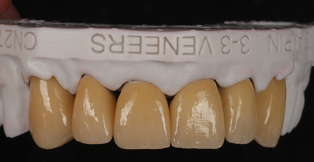 modern dental lab services