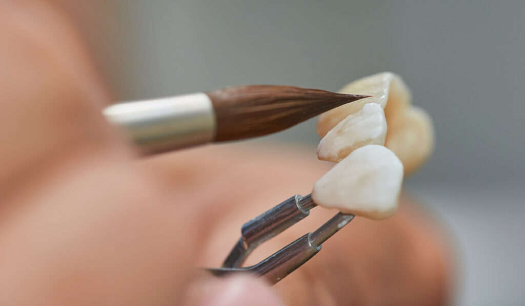 trainee dental technician working on dental bridge with brush