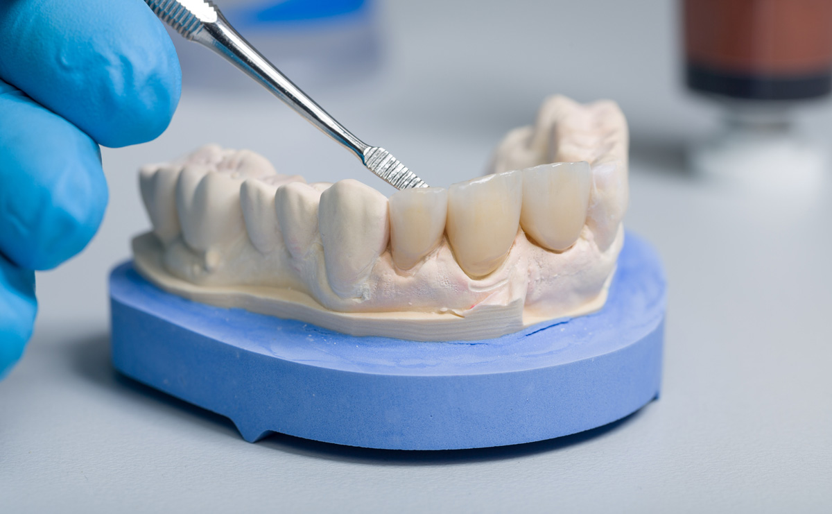 dental lab materials