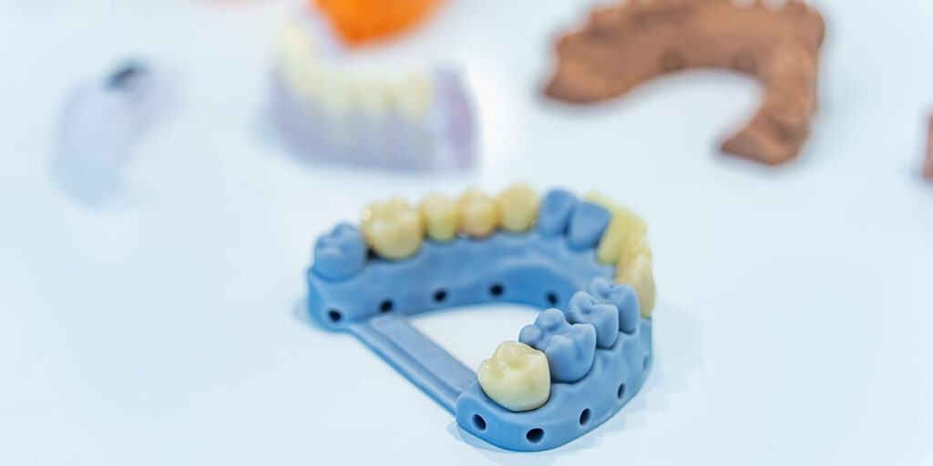 sets of dental lab ceramics and models showcasing digital dental workflow