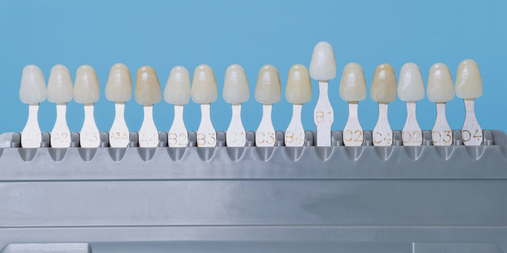 veneers holder and how dental labs avoid veneer translucency