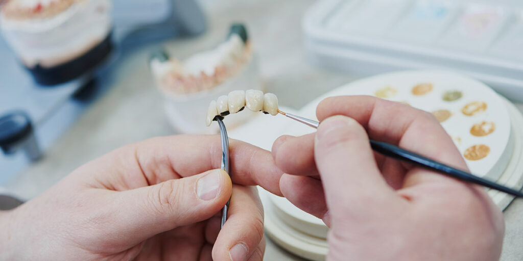 Man in dental lab working on dental bridge and dental laboratory communication