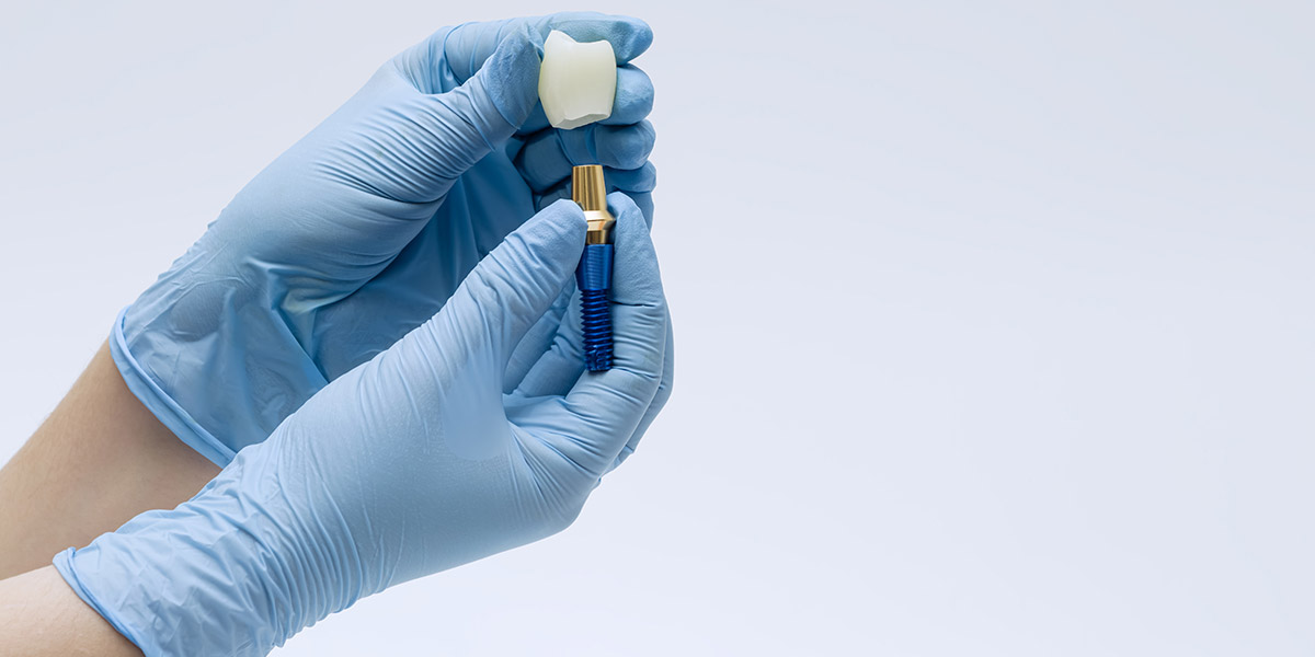 implant case planning