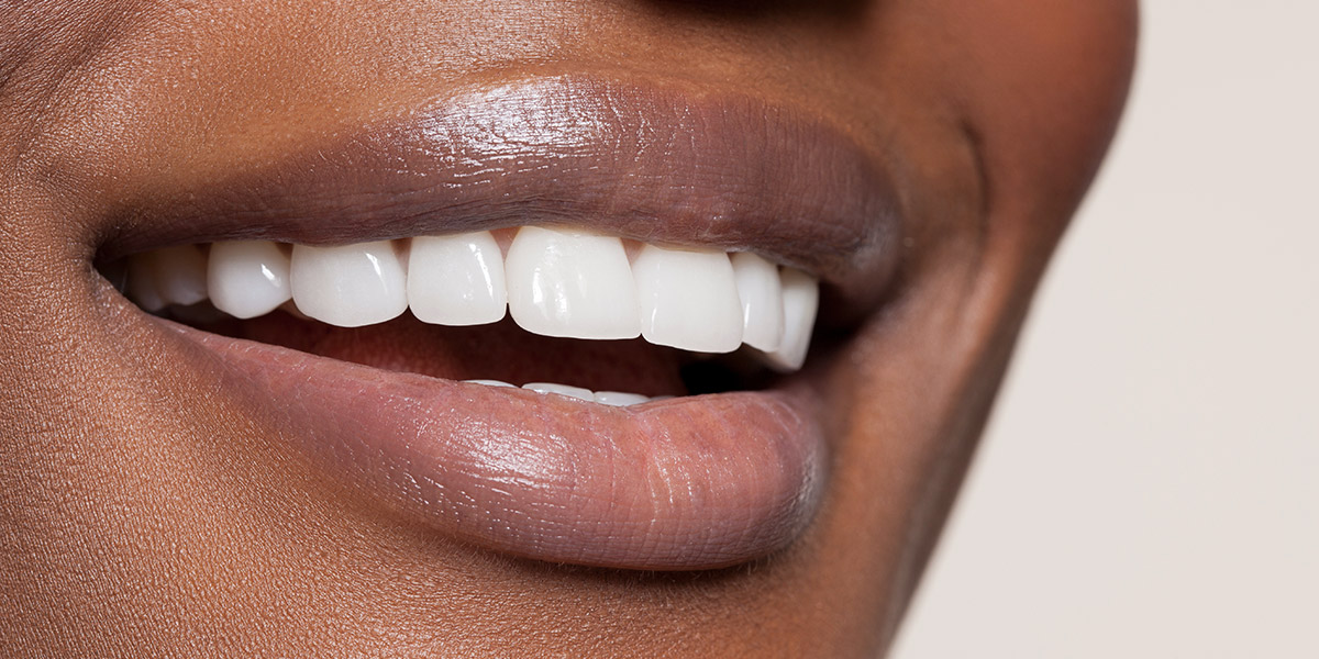implant crown aesthetics
