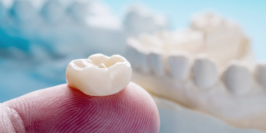 Dental crown on fingertip digital dental impressions