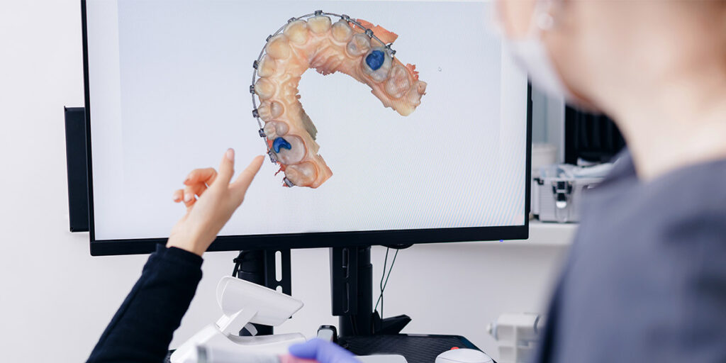 Hand pointing at monitor screen at digital scanning of teeth