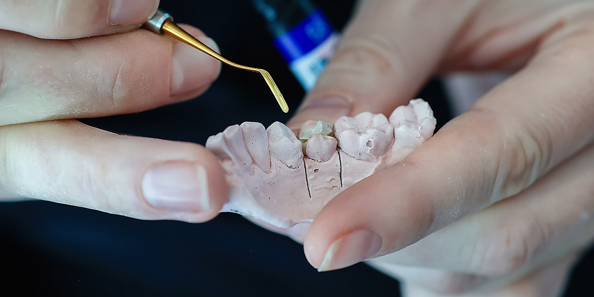 dental crown materials