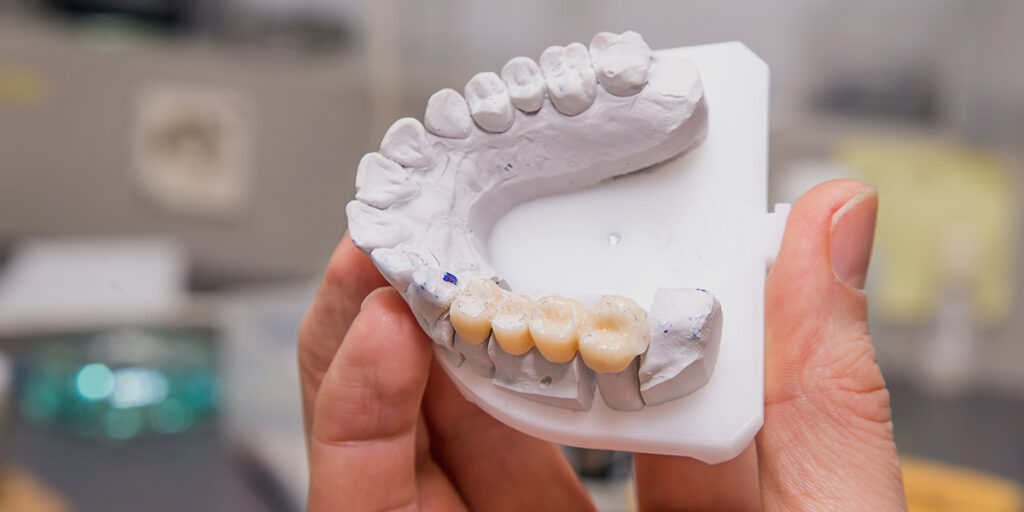 dental lab worker holding dental bridge