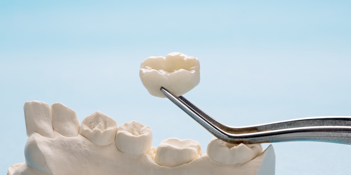 crown preparation